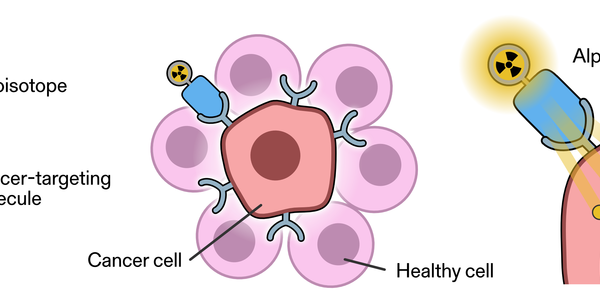 Diagram shows a radioisotope attached to a cancer-targeting molecule and how the molecule attaches to a cancer cell and injects alpha radiation. 